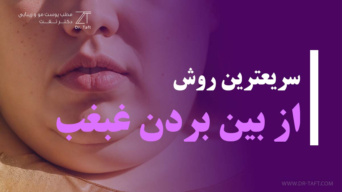 سریع‌ترین راه رفع غبغب