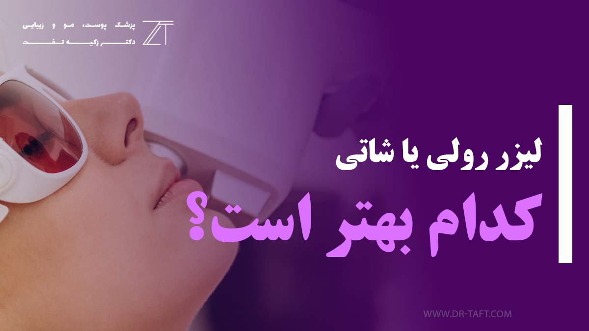 لیزر رولی بهتره یا شاتی