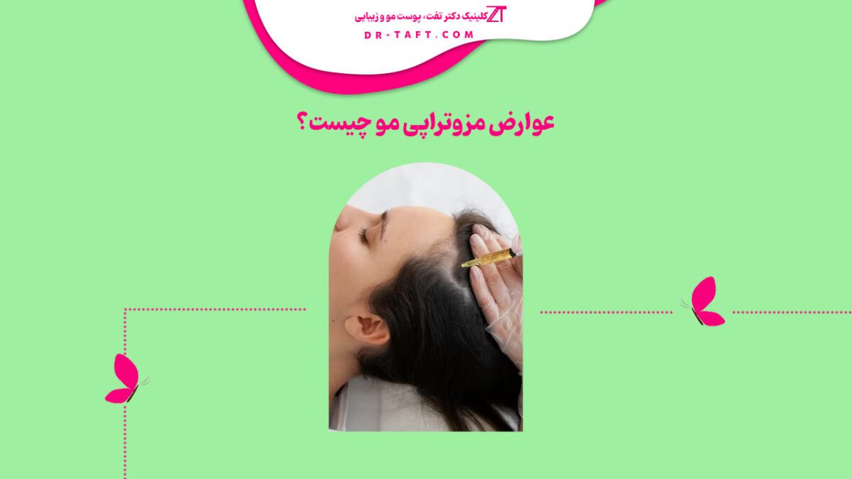 عوارض مزوتراپی مو چیست