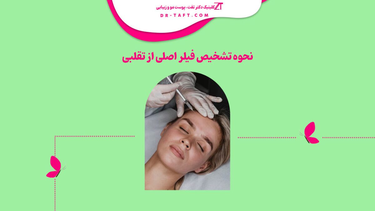 نحوه تشخیص فیلر اصلی از تقلبی