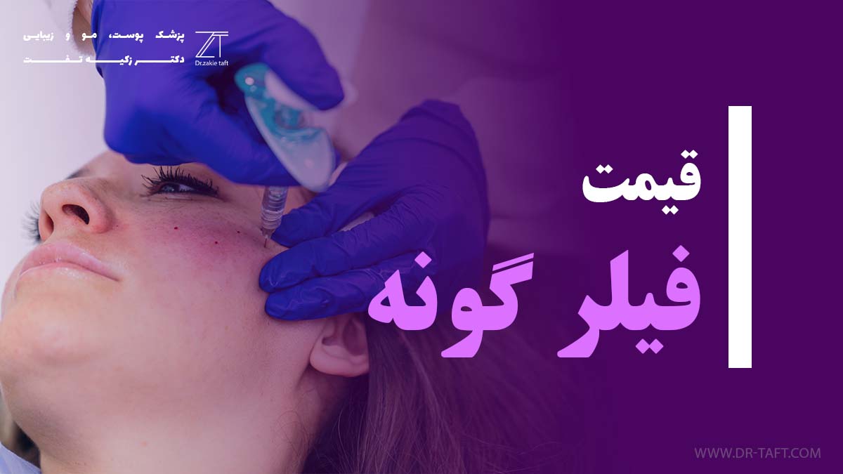 قیمت فیلر گونه 1404