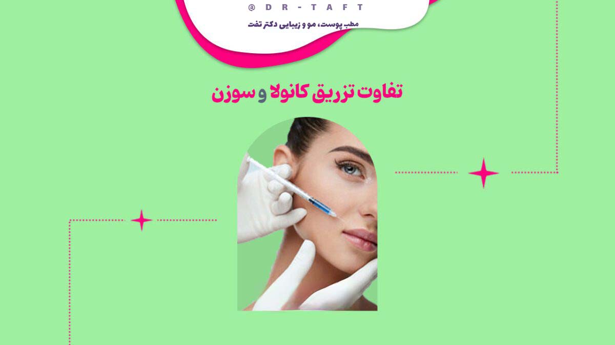 تفاوت تزریق کانولا و سوزن