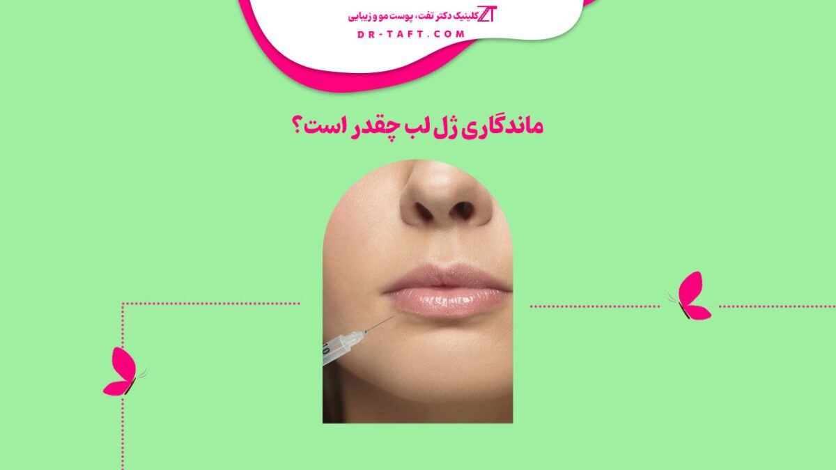 ماندگاری ژل لب چقدر است