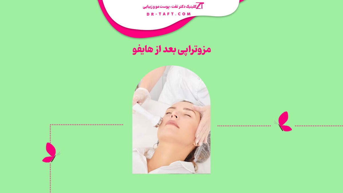 مزوتراپی بعد از هایفو