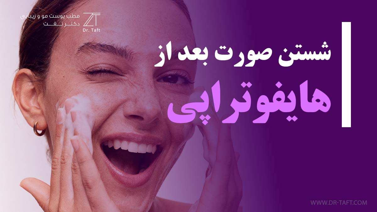 شستن صورت بعد از هایفو