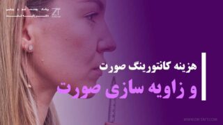 هزینه کانتورینگ صورت و زاویه سازی