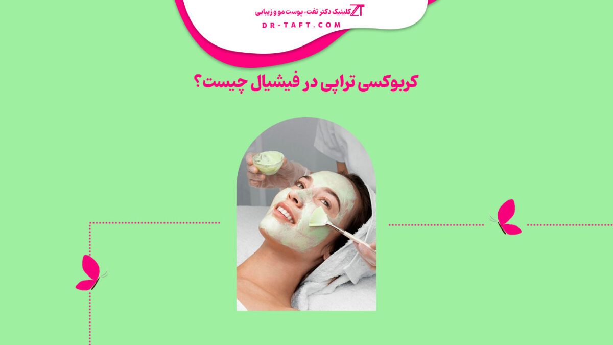 کربوکسی تراپی در فیشیال چیست