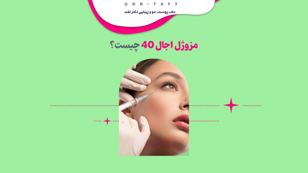 مزوژل اجال ۴۰ چیست