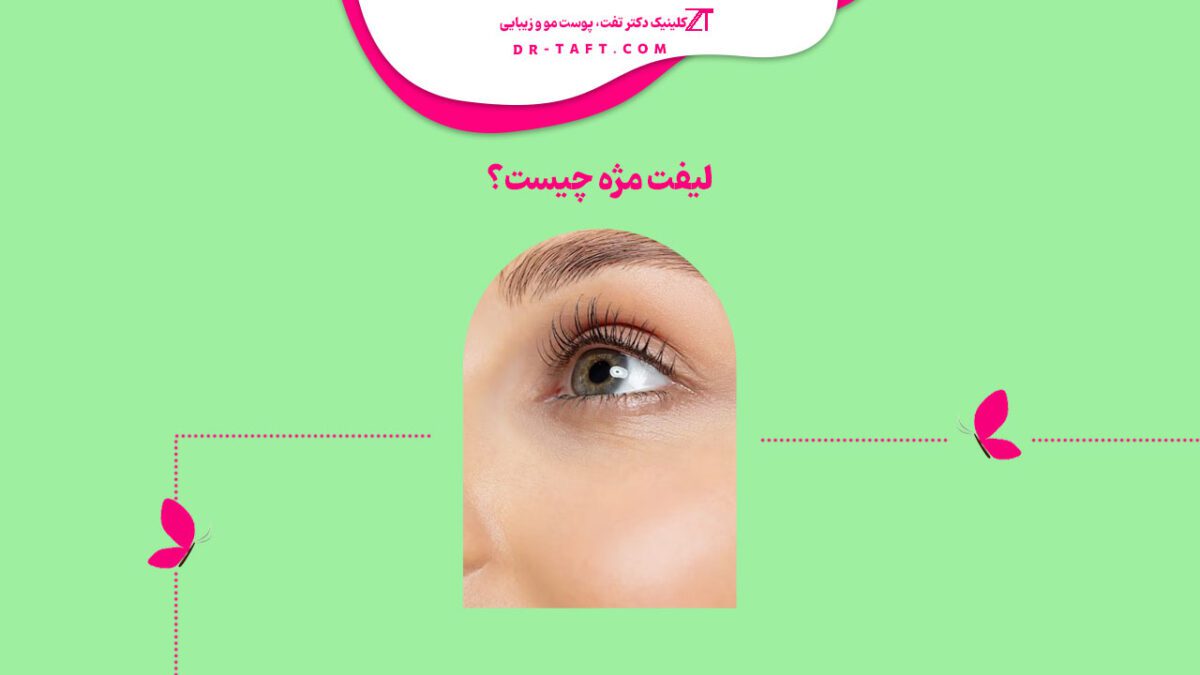 لیفت مژه چیست