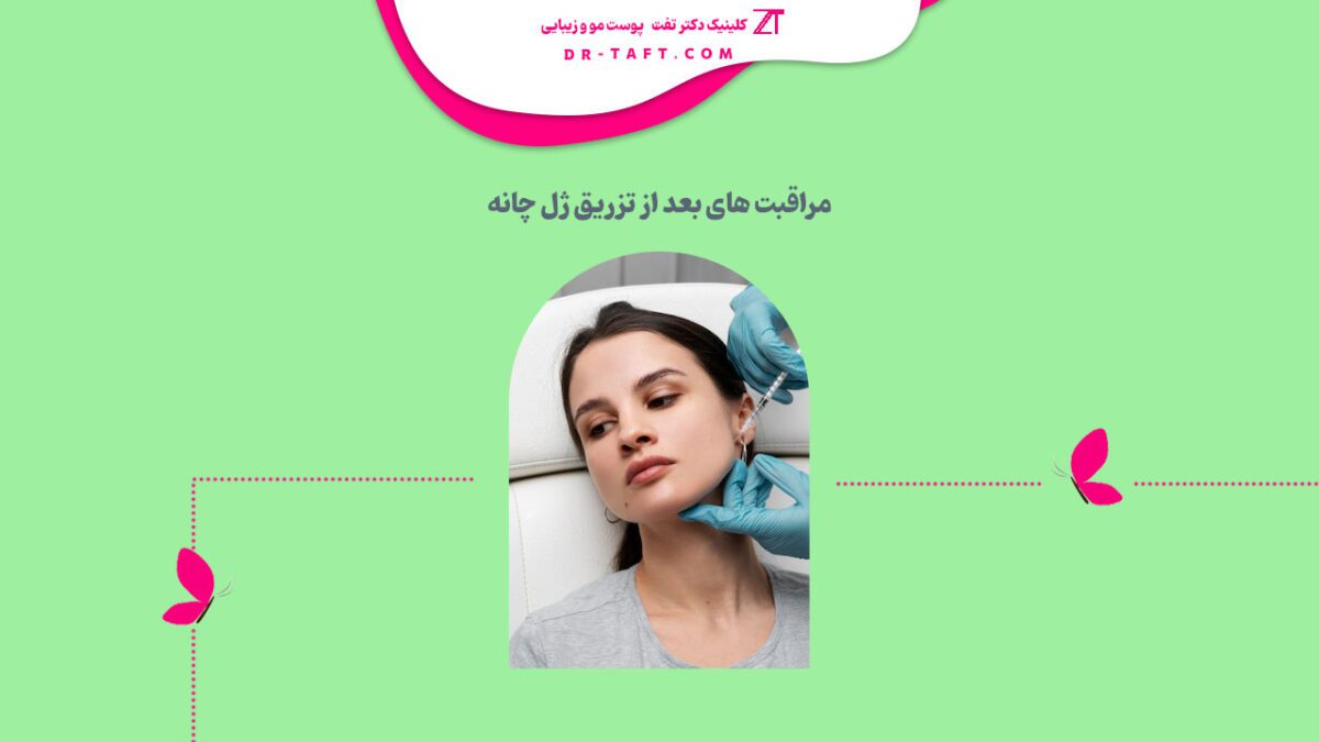 مراقبت های بعد از فیلر چانه