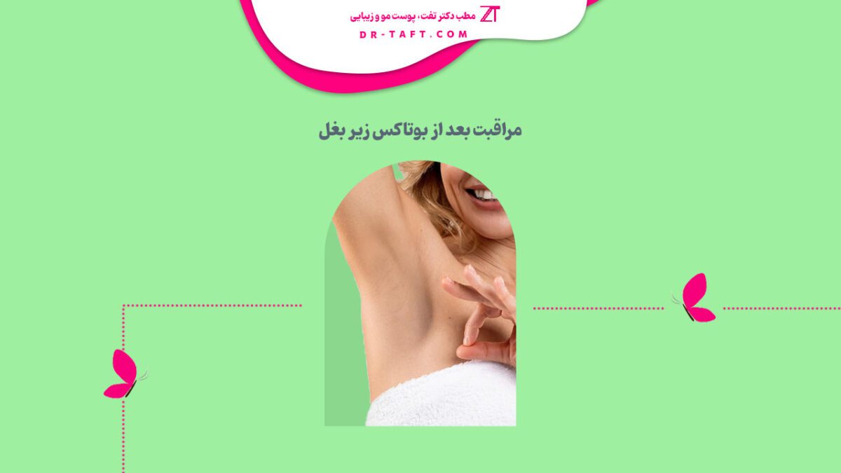 نکات مراقبت بعد از بوتاکس زیر بغل