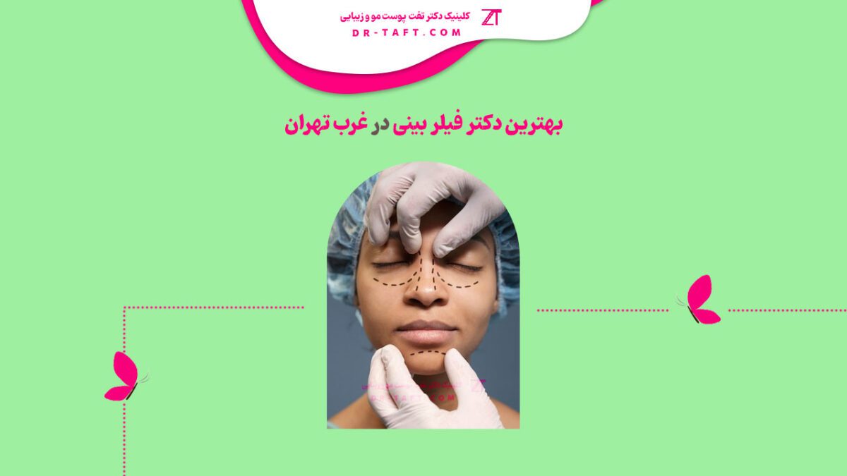 بهترین دکتر فیلر بینی در غرب تهران کیست