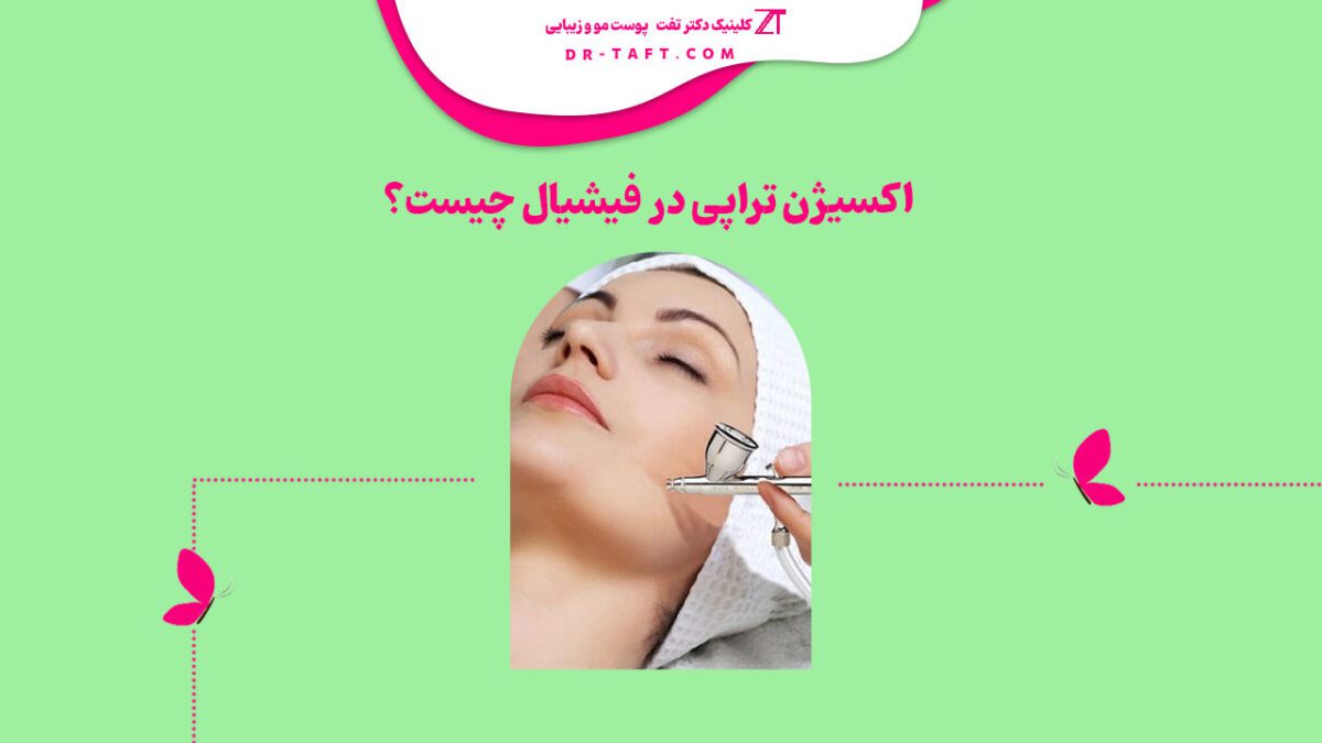اکسیژن تراپی در فیشیال
