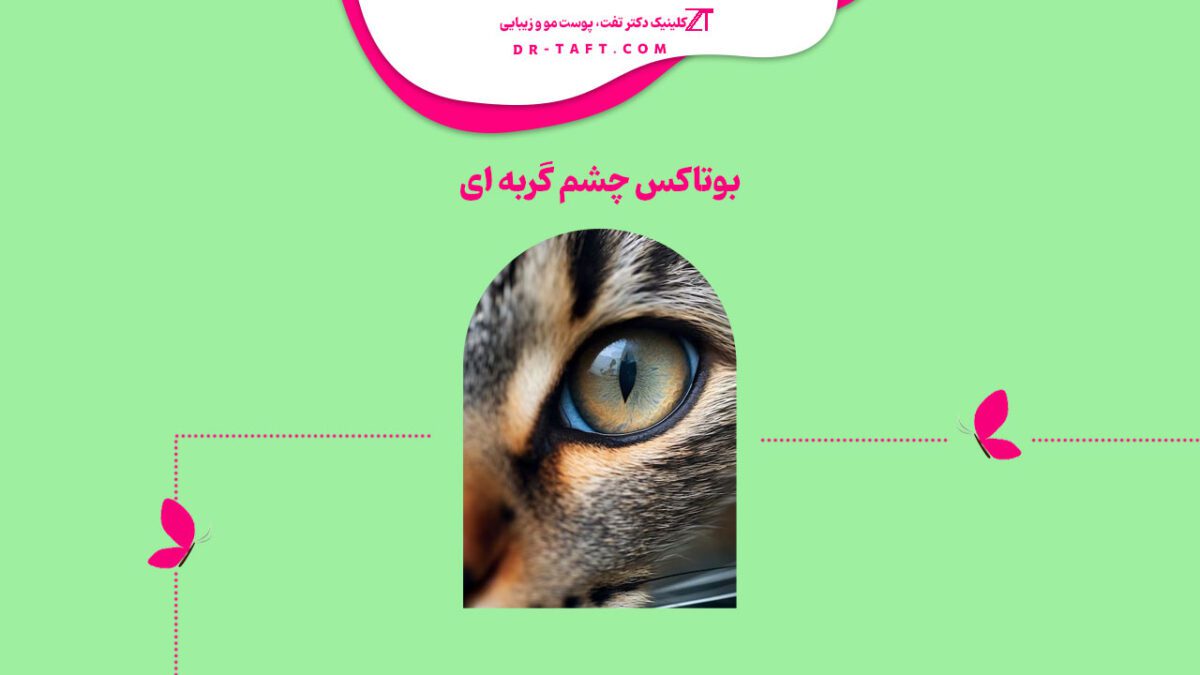 بوتاکس چشم گربه ای چیست