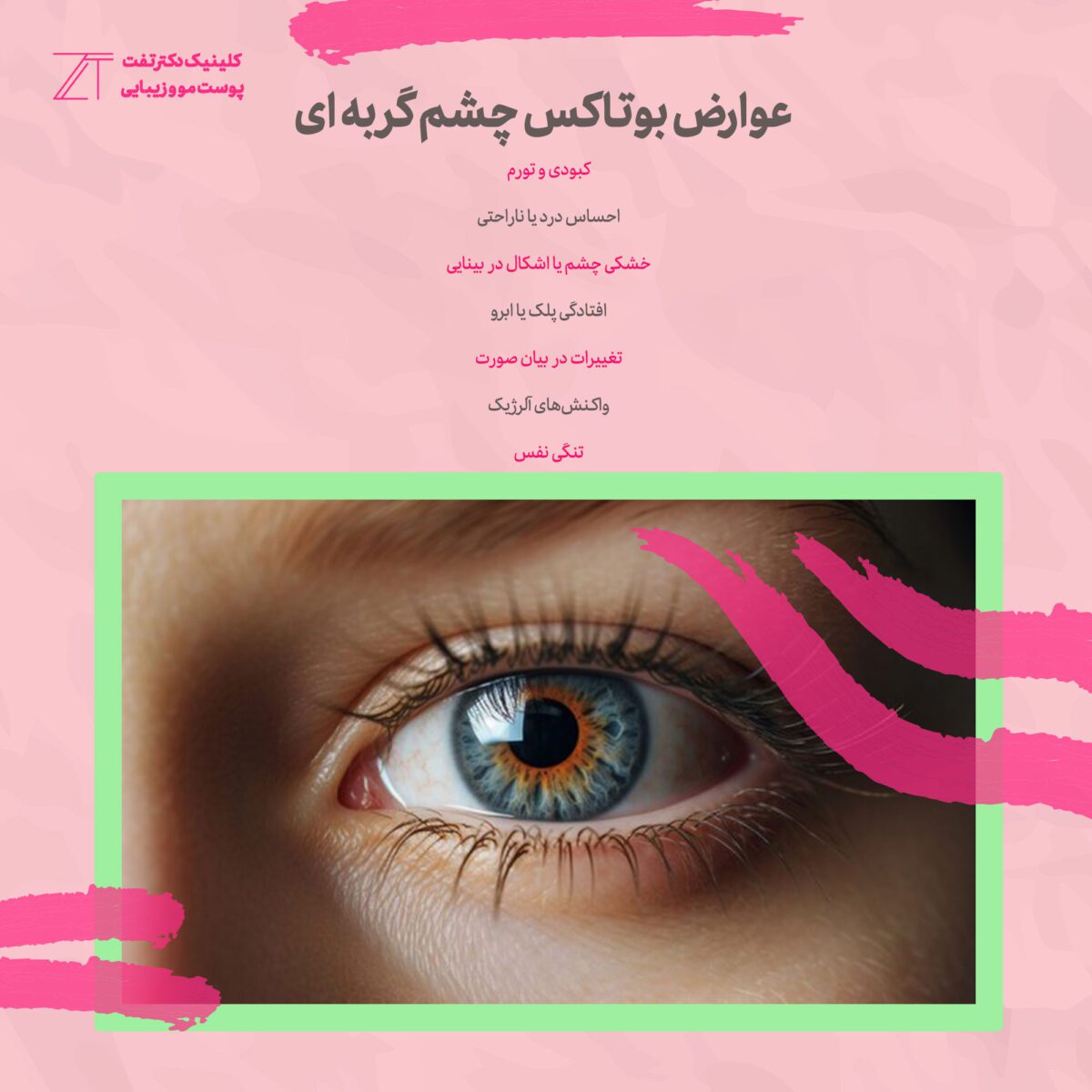 عوارض بوتاکس چشم گربه‌ای