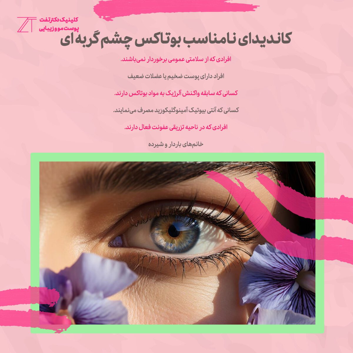 کاندیدای نامناسب بوتاکس چشم گربه‌ای