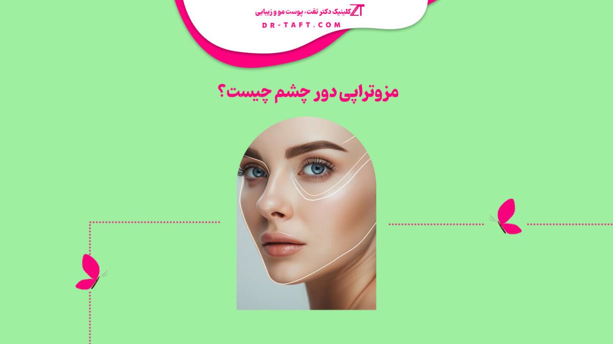 مزوتراپی دور چشم چیست