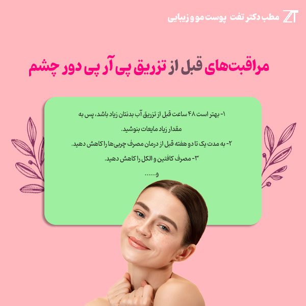 مراقبت‌های قبل از تزریق پی آر پی دور چشم