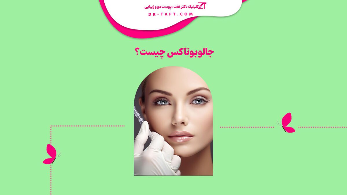 جالو بوتاکس چیست
