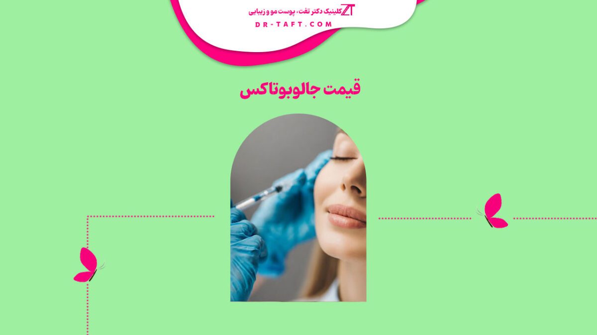 هزینه جالوبوتاکس