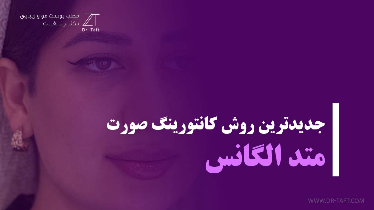 متدالگانس