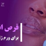 قرص اناهیل برای ورم ژل لب