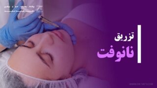 نانوفت چیست