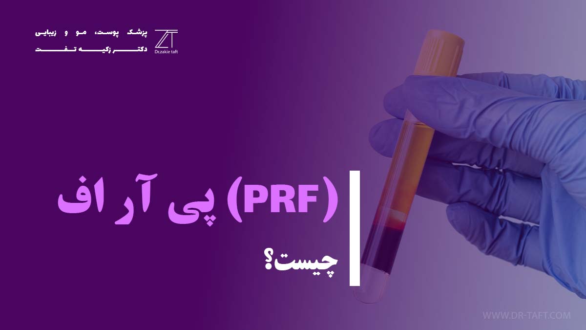 پی آر اف چیست