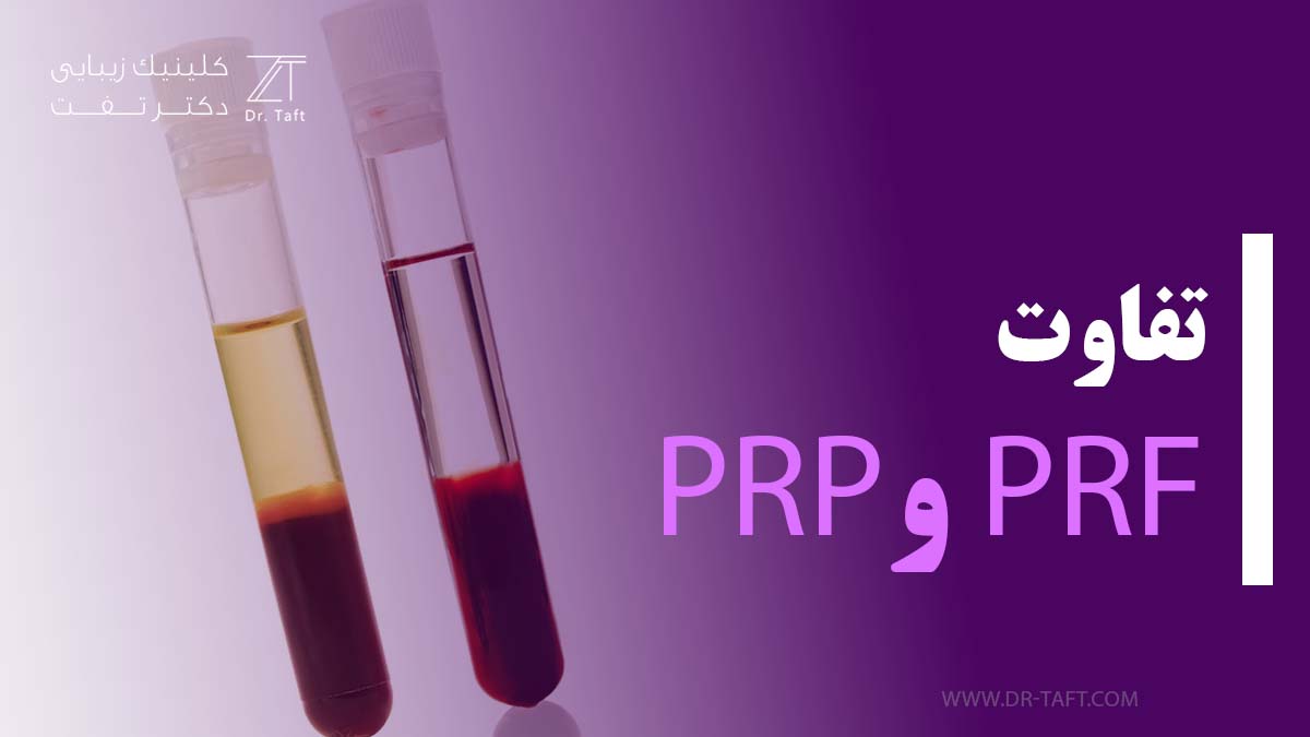 تفاوت پی ار پی و پی ار اف