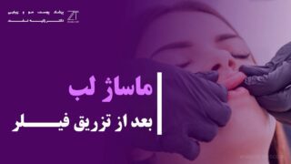 ماساژ لب بعد از تزریق ژل