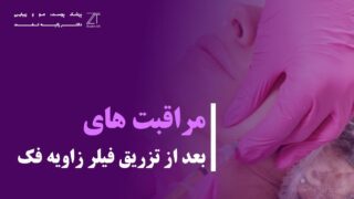 مراقبت های تزریق فیلر زاویه فک