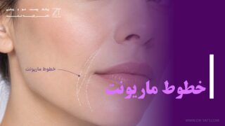 خطوط ماریونت