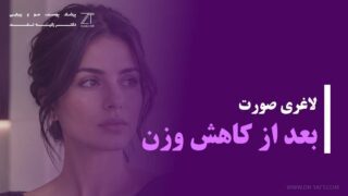 لاغری صورت بعد از کاهش وزن