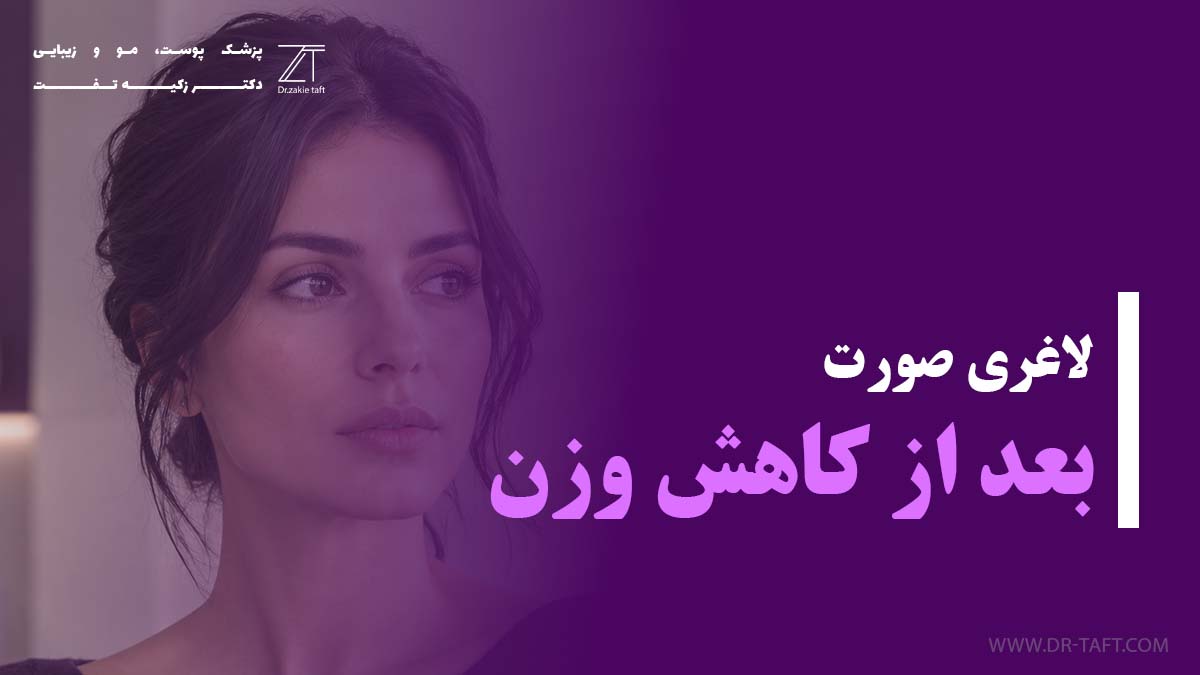 لاغری صورت بعد از کاهش وزن
